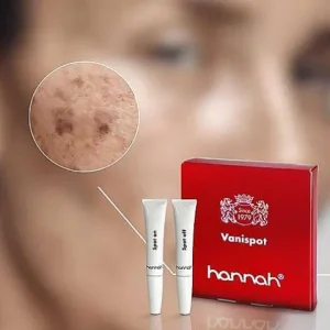 Vanispot 2X8Ml<hannah Cheap